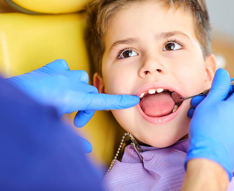 Tratamientos dentales preventivos