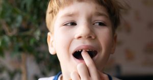 niño arreglar diente roto odontopediatra