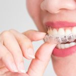 Mujer sonriendo y quitándose la ortodoncia invisible