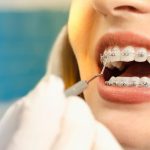 mujer con brackets en una revisión del tratamiento de ortodoncia